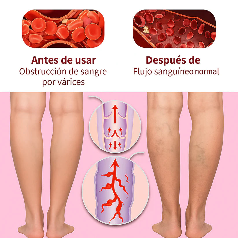 Varicream™ – Alivio Natural para Tus Piernas